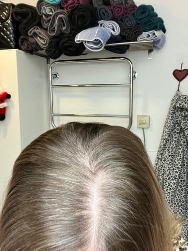 Customer photo review of Sunkissed Refill 3-pack