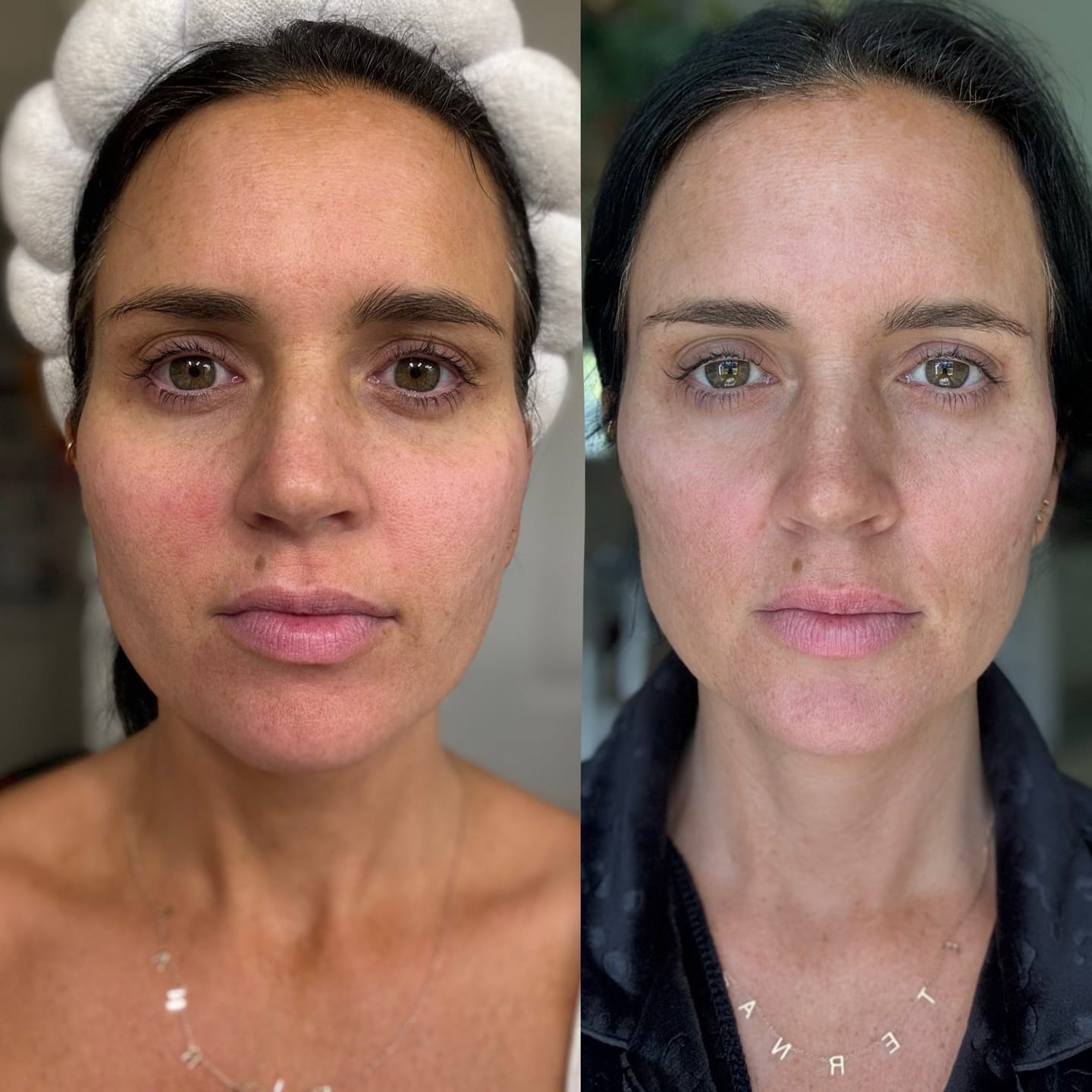 Customer photo review of GLOW WAND