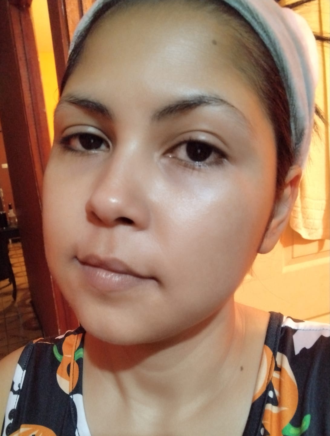 Customer photo review of Hyaluronic Acid Aqua Gel Cream