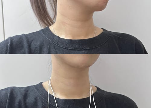 Customer photo review of 二代微電流蛋白機＋多因子超導修護面膜（含撫紋脖膜）