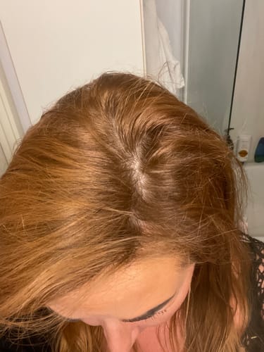 Customer photo review of Sunkissed Refill