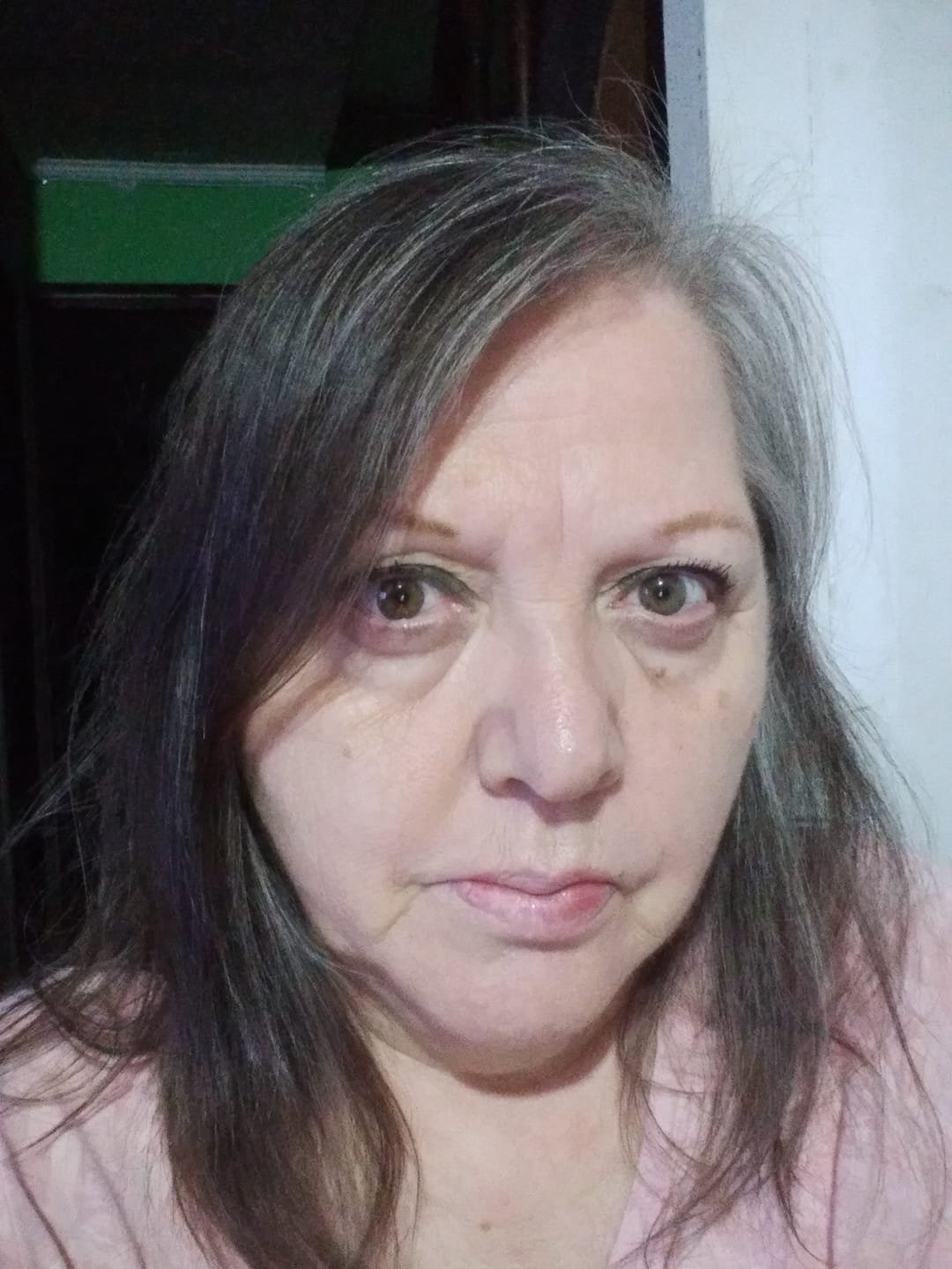 Customer photo review of Shampoo Anticaída Jaborandi 300ml