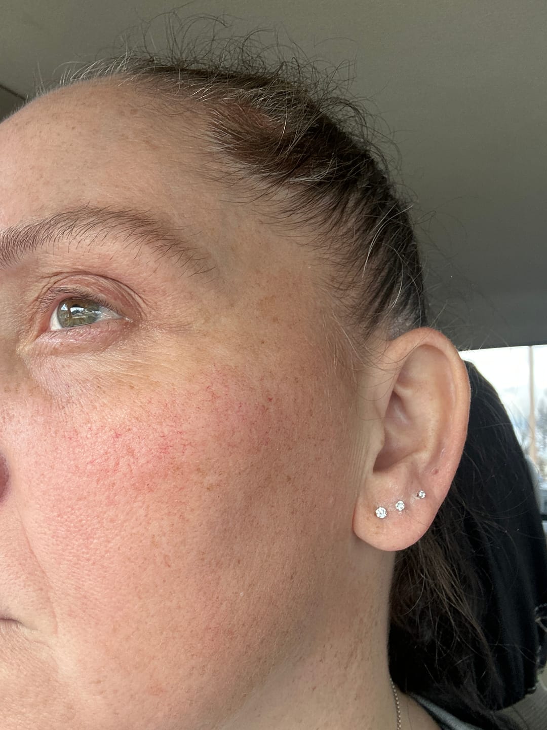 Customer photo review of Solitaire Piercing Stacking Set