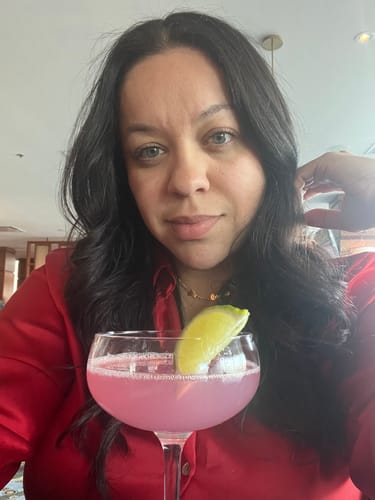 Customer photo review of WrinkleFix: Unlimited Toxins Membership Auto renew (Ships every 30 Days)