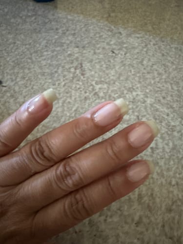 Customer photo review of Route Package Protection