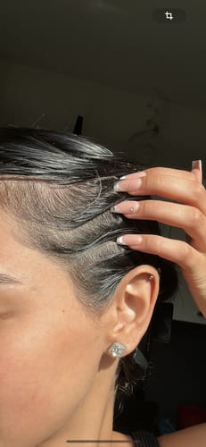 Customer photo review of TRÈS[S] GROWN - Hair Growth Spray