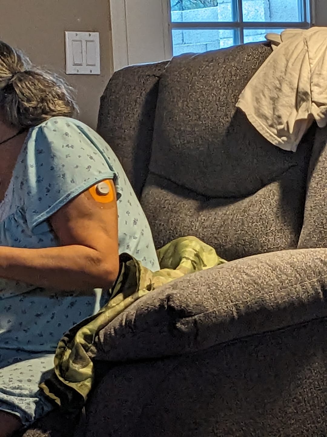 Customer photo review of Skin Grip Original - Dexcom G7 Adhesive Patches (With Cutout)