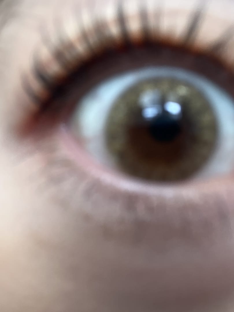 Customer photo review of Suzy Brown (30Pcs) Daily Colored Contacts
