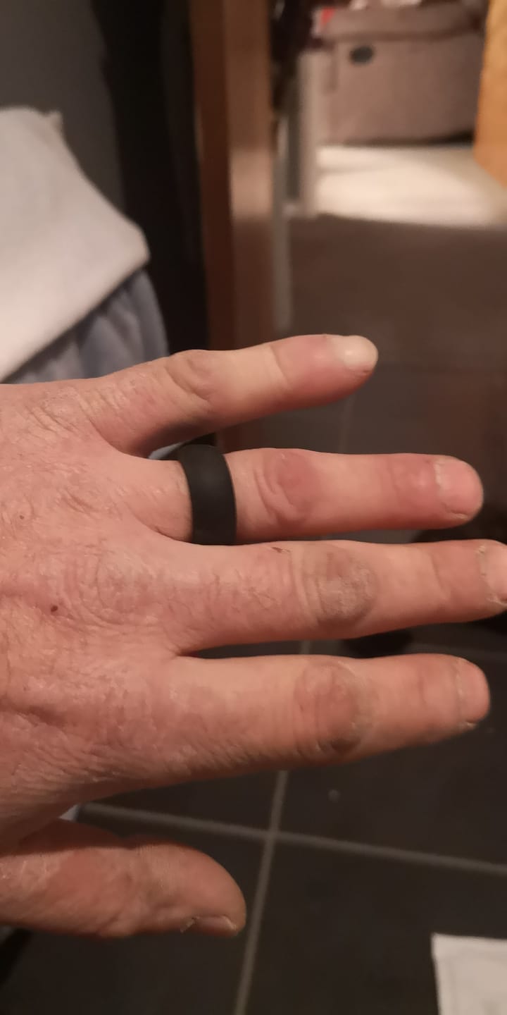 Customer photo review of botthms Black Active Silicone Ring