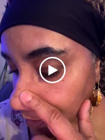 Customer video review of Carotis 7 Day Lightening Cream with Vitamin A (Jar) - 300ml / 10.14 fl oz
