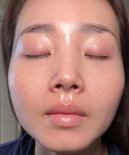 Customer photo review of Masque Coréen au Collagène Invisible (Joues et front)