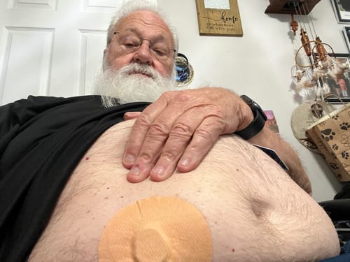 Customer photo review of Skin Grip MAX Dexcom G7 Patches
