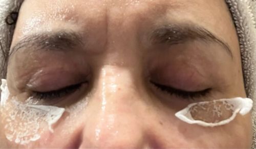 Customer photo review of Masque Coréen au Collagène Invisible (Yeux)