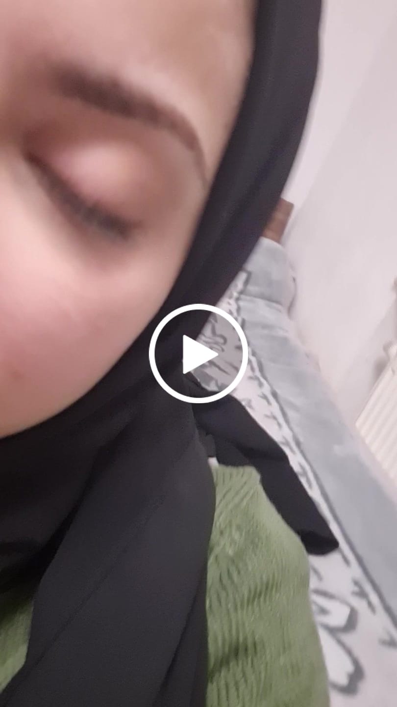 Customer video review of 2Dadoll Calico Brown Contact Lenses(1 pair/6 months)