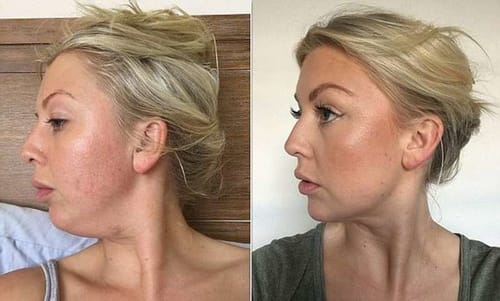 Customer photo review of Lymph Flow Magnetogen Earrings（🔥LAST DAY SALE-80% OFF)