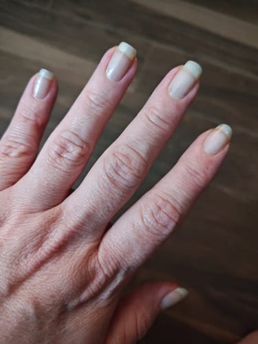 Customer photo review of Limited Edition Daydream Kit