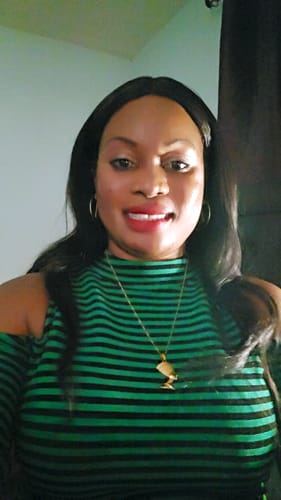 Customer photo review of Organic Exfoliating Cream with SPF (for darks spots and sunburns)