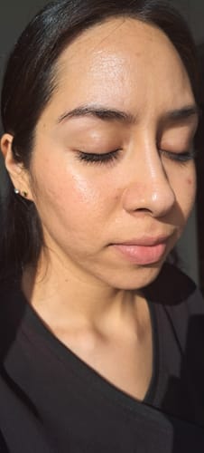 Customer photo review of Dermolimpiador acne control