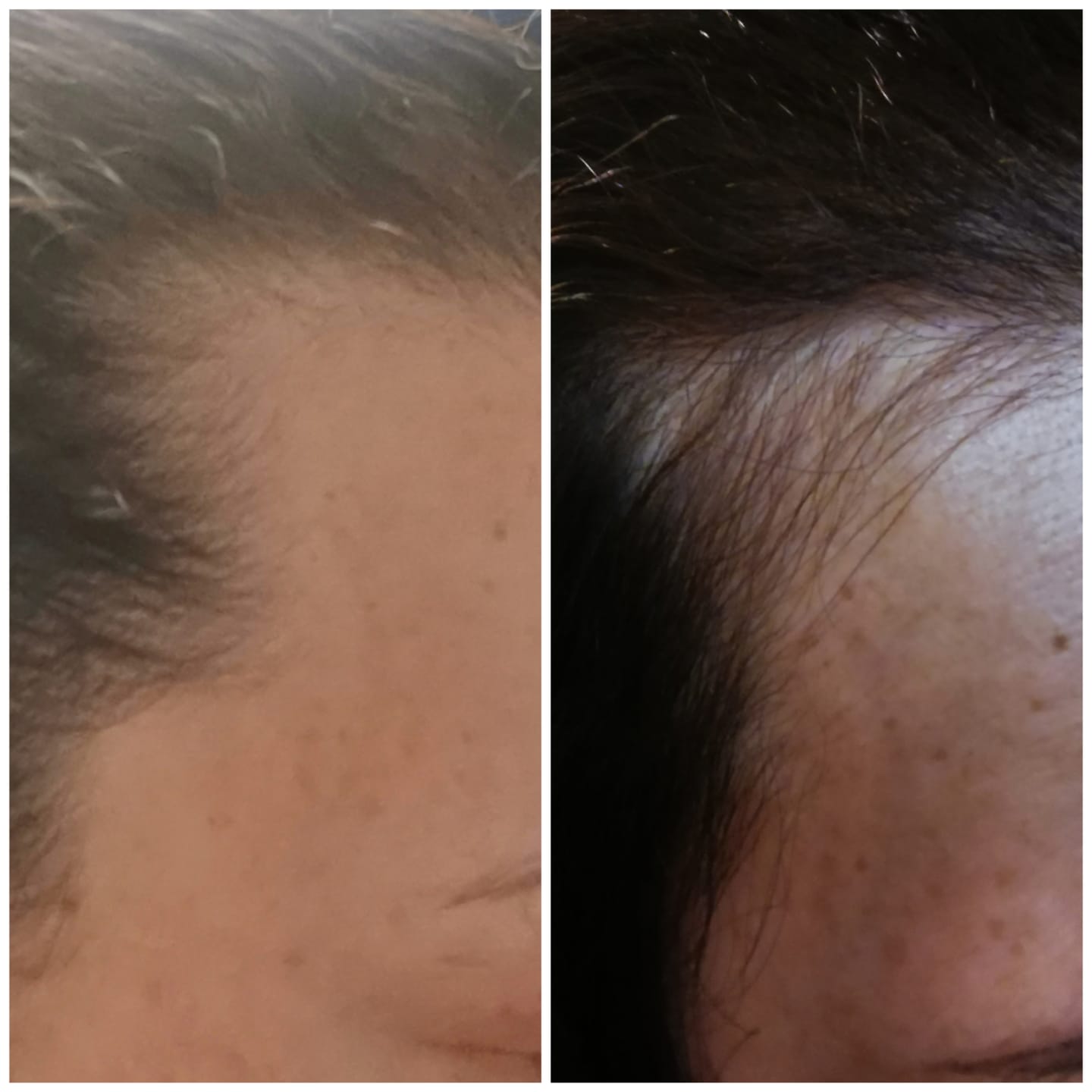 Customer photo review of TRÈS[S] GROWN - Hair Growth Serum