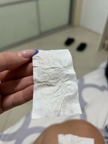 Customer photo review of Masque anti points noirs + 60 bandes offertes