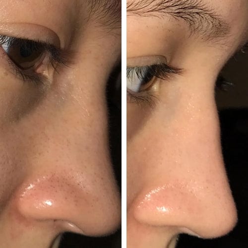 Customer photo review of Masque anti points noirs + 60 bandes offertes