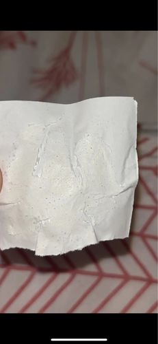 Customer photo review of Masque anti points noirs + 60 bandes offertes