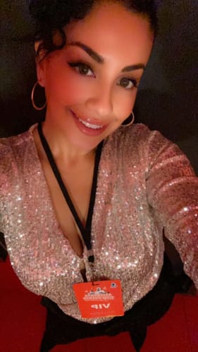 Customer photo review of WrinkleFix: Botox Membership Auto renew