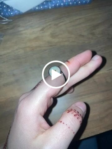 Customer video review of Bague d'Anxiété Ajustable - DAISY