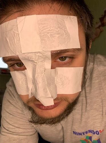 Customer photo review of Luelle Pore Strips