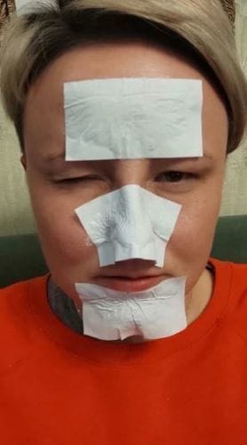 Customer photo review of Luelle Pore Strips