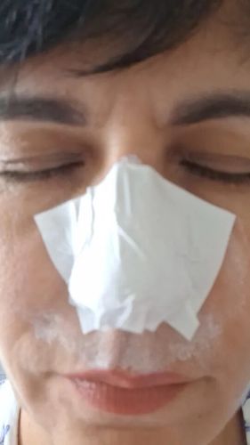 Customer photo review of Masque anti points noirs + 60 bandes offertes