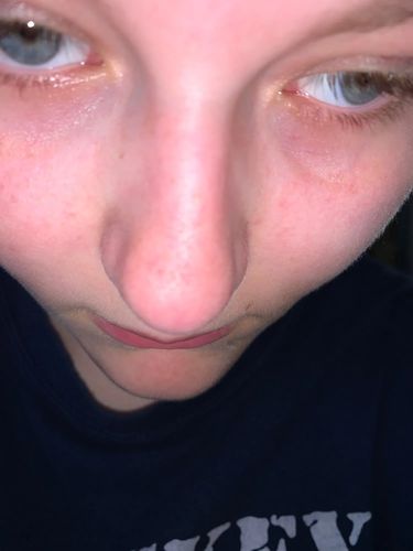 Customer photo review of Masque anti points noirs + 60 bandes offertes