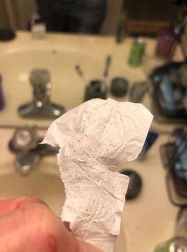 Customer photo review of Luelle Pore Strips