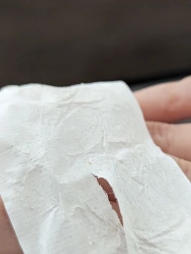 Customer photo review of Masque anti points noirs