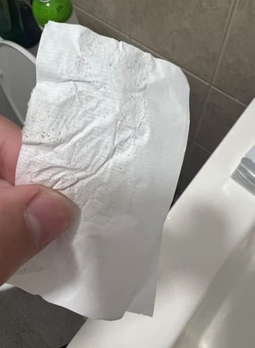 Customer photo review of Luelle Pore Strips