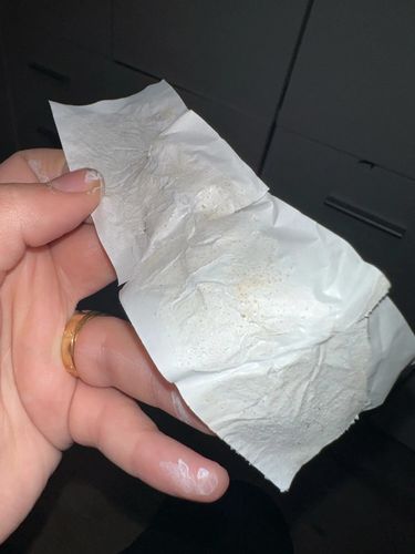 Customer photo review of Masque anti points noirs + 60 bandes offertes