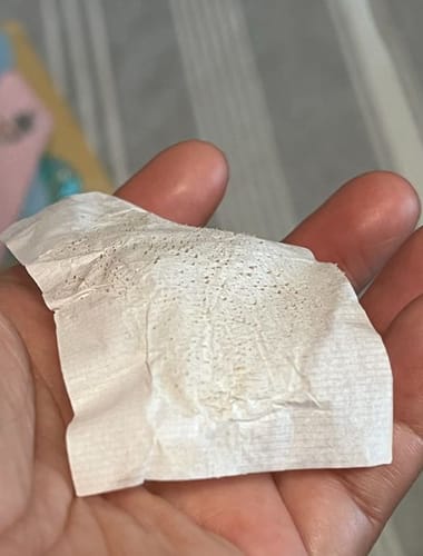 Customer photo review of Luelle Pore Strips