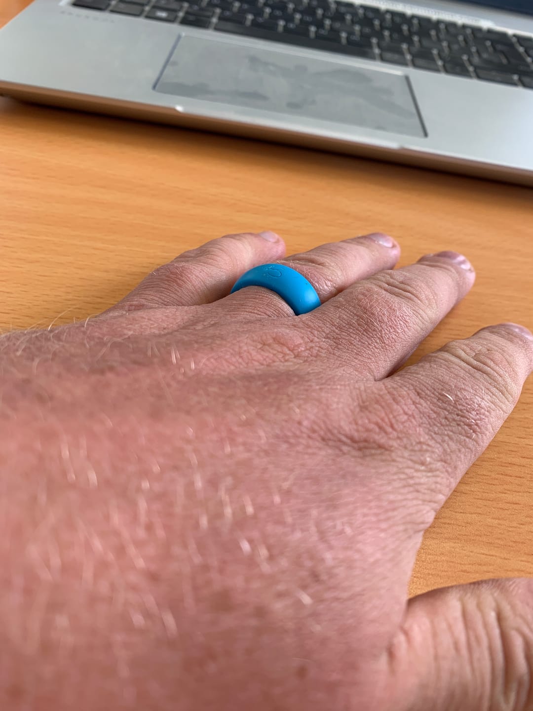 Customer photo review of botthms Turquoise Active Silicone Ring