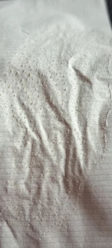 Customer photo review of Masque anti points noirs + 60 bandes offertes