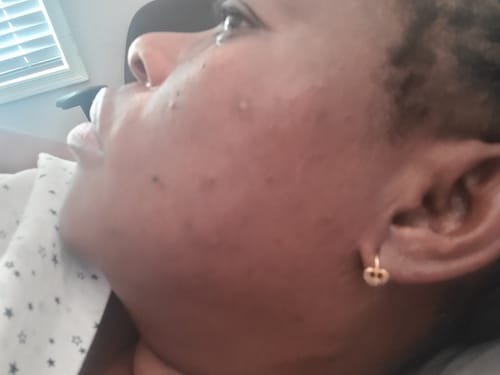 Customer photo review of Dark spot serum