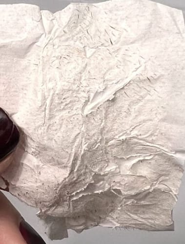 Customer photo review of Luelle Pore Strips