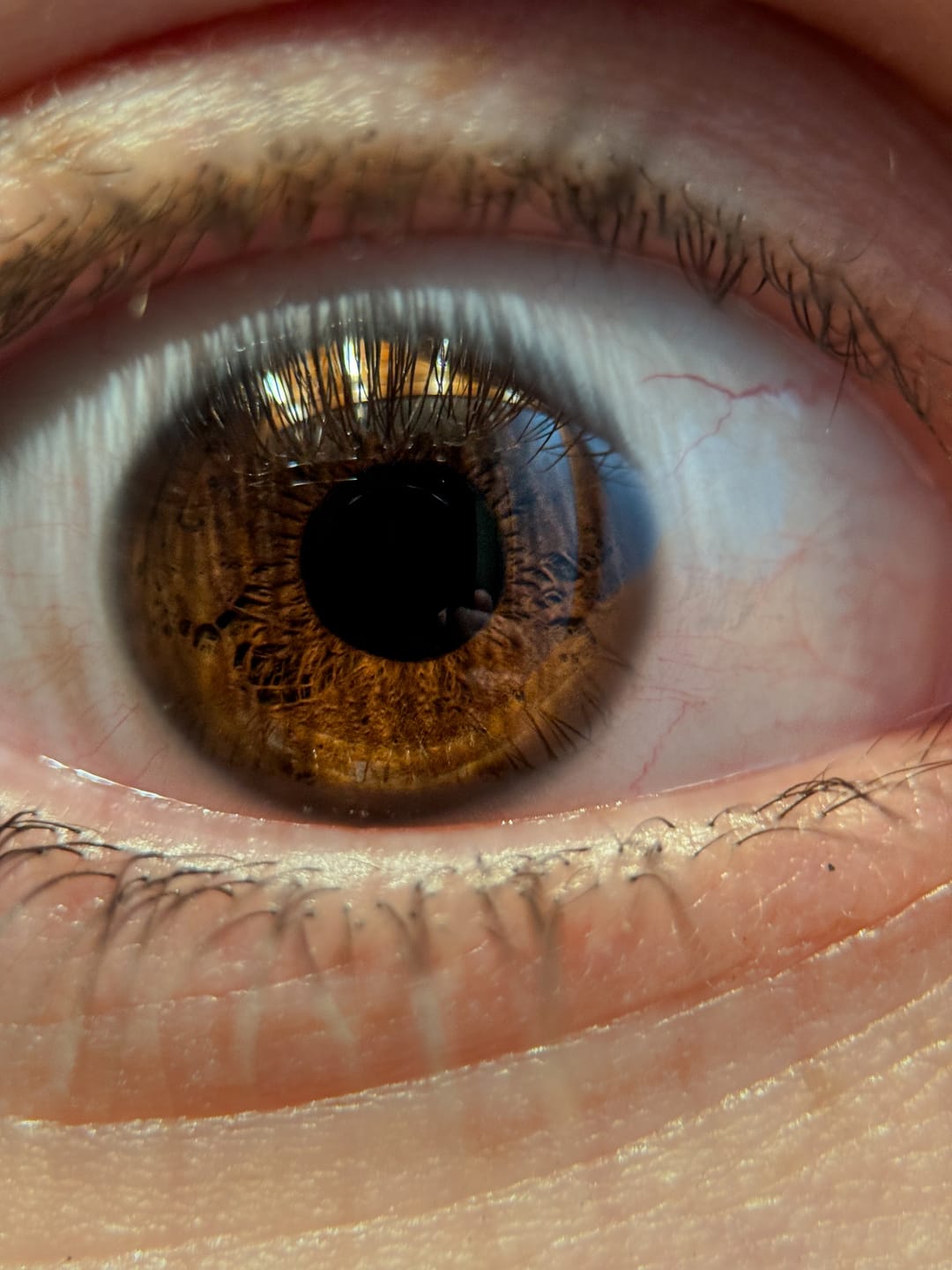 Customer photo review of Pro Series - Macro Lens
