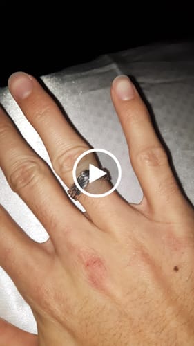 Customer video review of SOAR RING