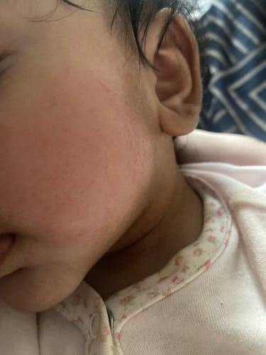 Customer photo review of Kokoso Baby® Coconut Oil