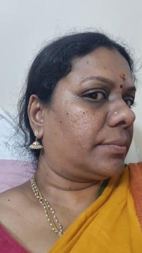 Customer photo review of Turmeric Night Repair Cream