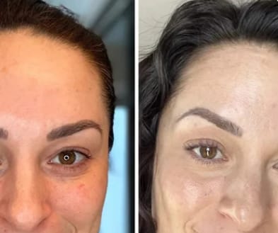 Customer photo review of Glow up Glasses - Augenringe Entferner