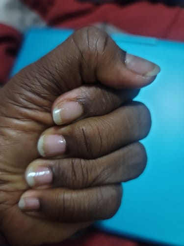 Customer photo review of The Nail Starter Kit