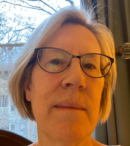 Customer photo review of Radiation Relief Cream – Unscented Burn Cream for Radiation Therapy