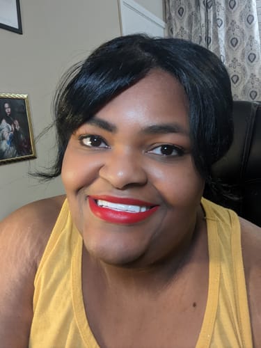 Customer photo review of Pop On Veneers with Impression Kit