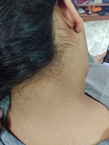 Customer photo review of 2 Paquetes Inositol Ratio 40:1 Polvo Myo Inositol & D Chiro Inositol, Oby Pure Inositol 7 ingredientes